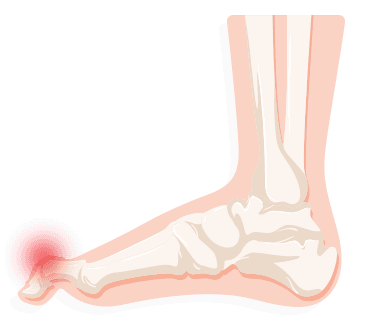 foot pop pain