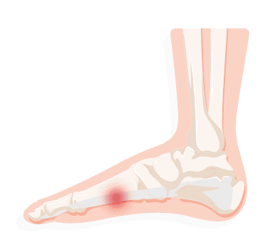 sharp pain on bottom of foot near heel